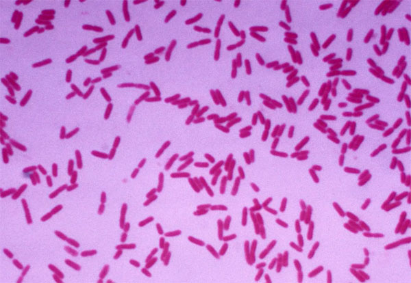 微生物在水產養殖環境修復中的作用